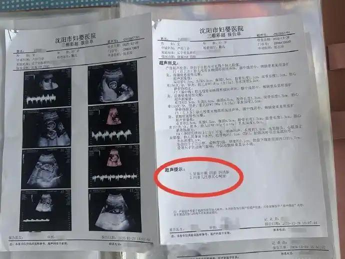 活久见！辽宁抚顺，女子怀孕后去做产检，可令她没想到的是，每做一次产检，彩超单上都