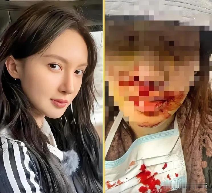 我问一个在医院工作的朋友，金晨在绍兴撞伤脸，为什么不在当地处理，非要赶去上海？