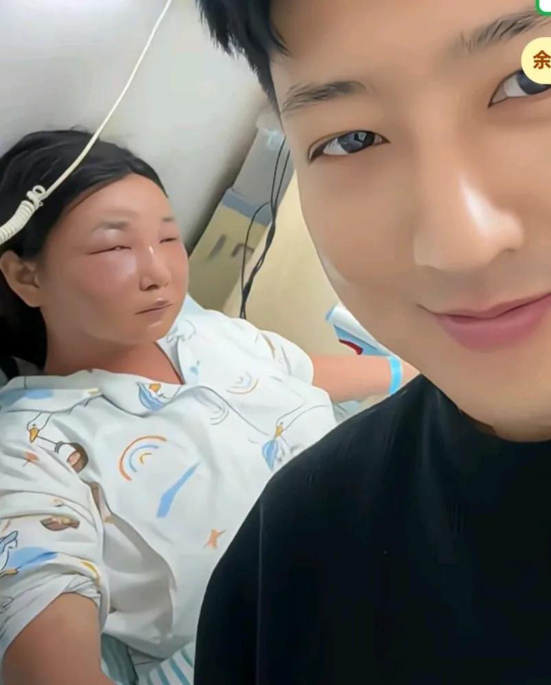 男子称妻子爱干净一天洗八百遍手，洗的太频繁导致脸部水肿住院治疗。网友说，手过敏