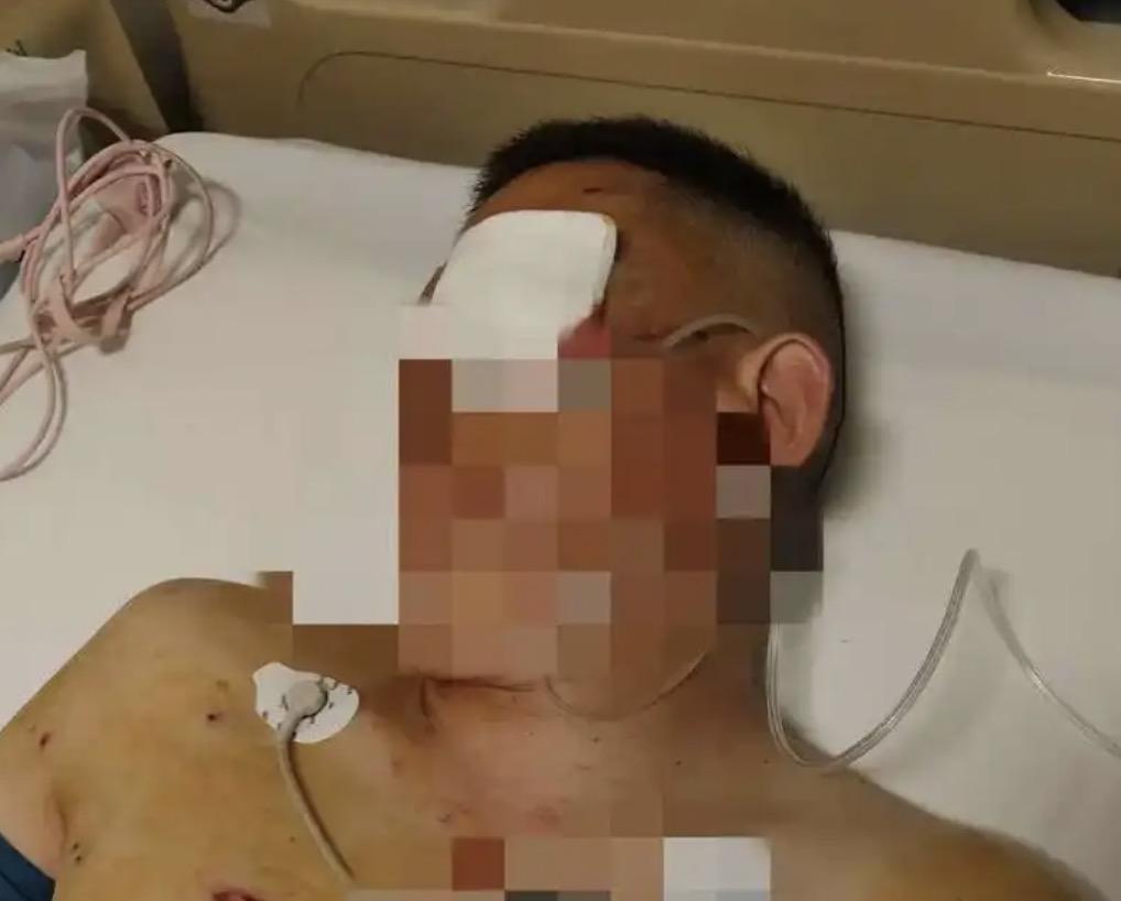 男子取了170万的现金在银行门口遭抢，他在与歹徒搏斗近20分钟的时间内，银行工作