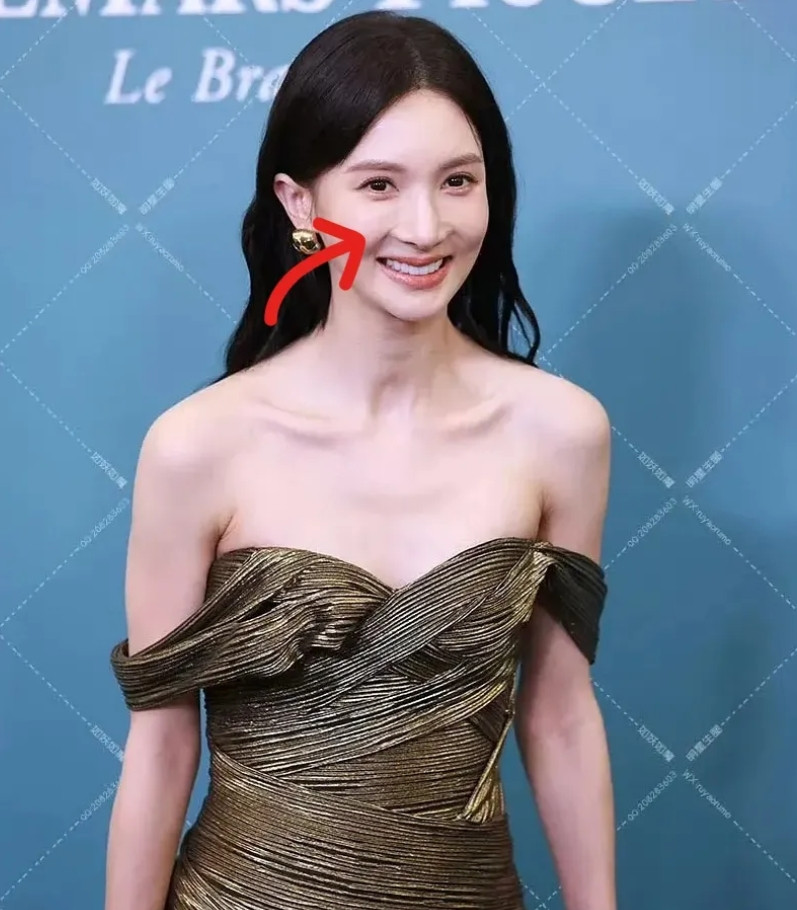 金晨你糊涂啊！这下好了，金晨今天又要气的睡不着了！本以为金晨虽然鼻子动过，但是很
