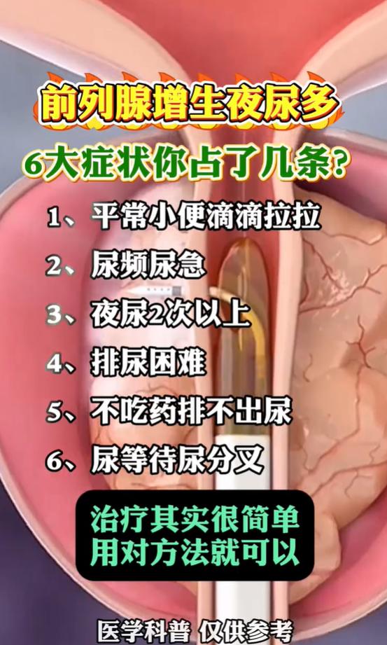 小便滴沥、尿等待起夜多，多半是前列腺增生，找对调理思路很关键