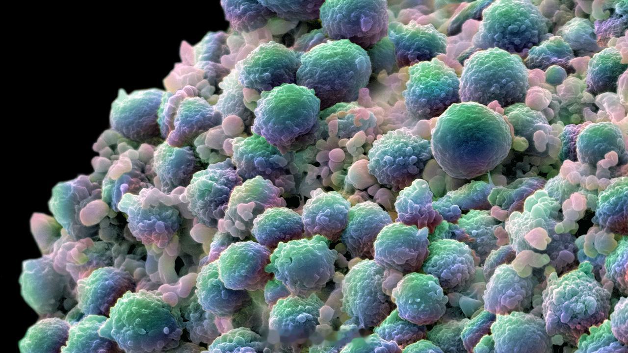 前例腺癌症的新型纳米颗粒疗法在试验中美国康奈尔大学和康奈尔医学院研究团队开发出