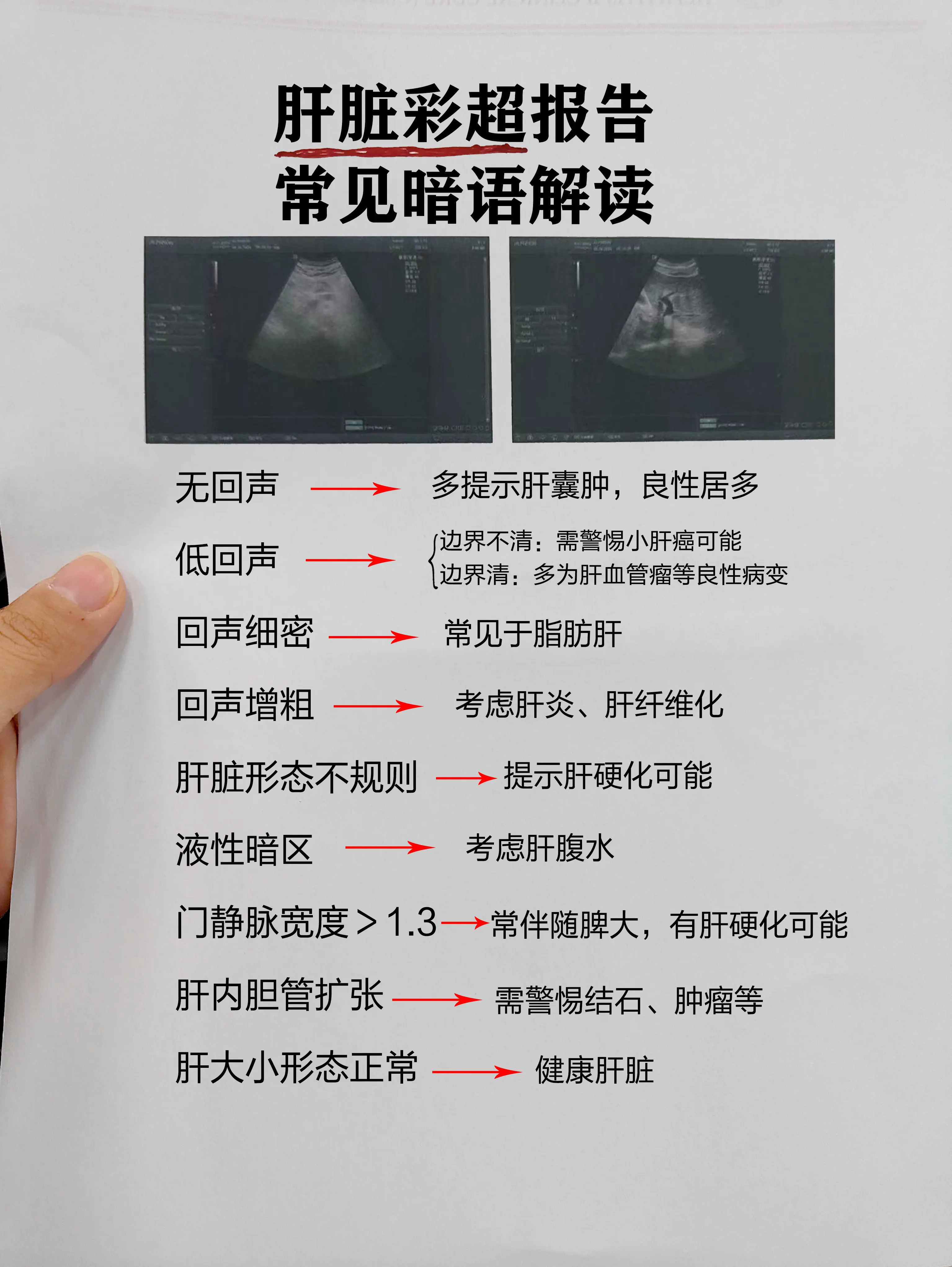 肝友们，拿到肝脏彩超先别慌，这些报告上的术语要看懂。有异常别自己吓自己...