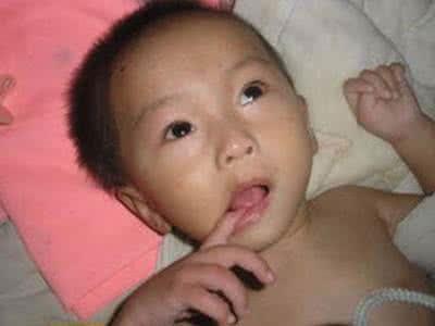 无知父母粗心大意选用了它, 导致4个月大宝宝成脑瘫患儿