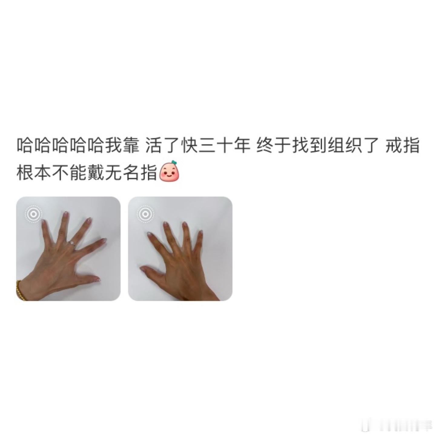 原来手蹼会影响戴戒指的美观