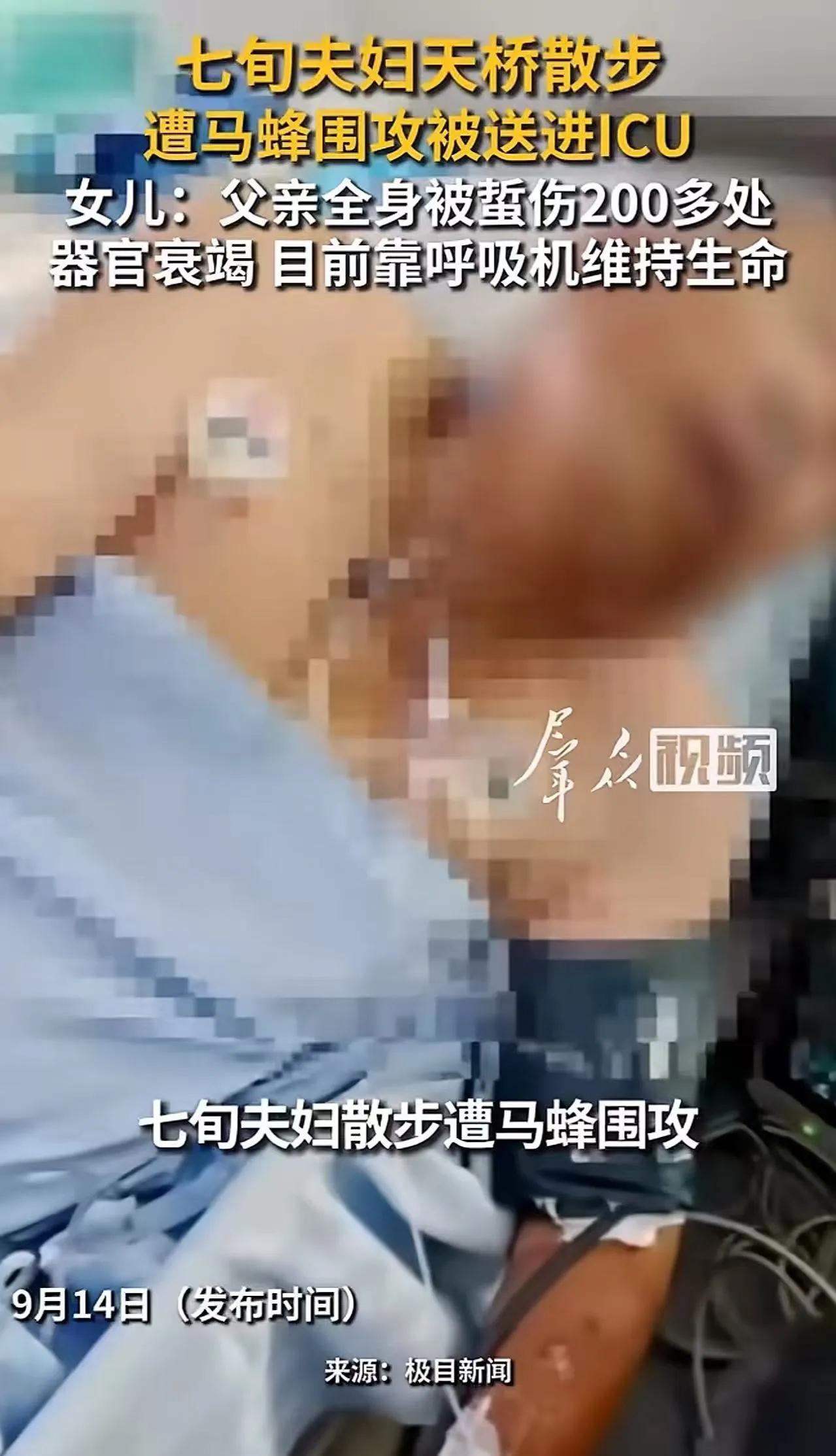70多岁的老两口只是去河边走走，经过人行天桥时突然遭到马蜂群袭击，老人身上被蜇2