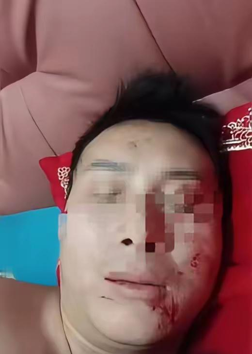 离大谱了！四川达州，一男子新婚燕尔，想和新娘过夫妻生活，可妻子拒绝，一把抓他脸上