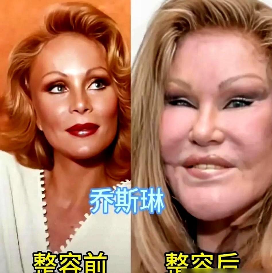 闫妮这张脸，真是个谜。前脚还是风情万种的佟掌柜，后脚就变成了苹果肌饱满的冻龄