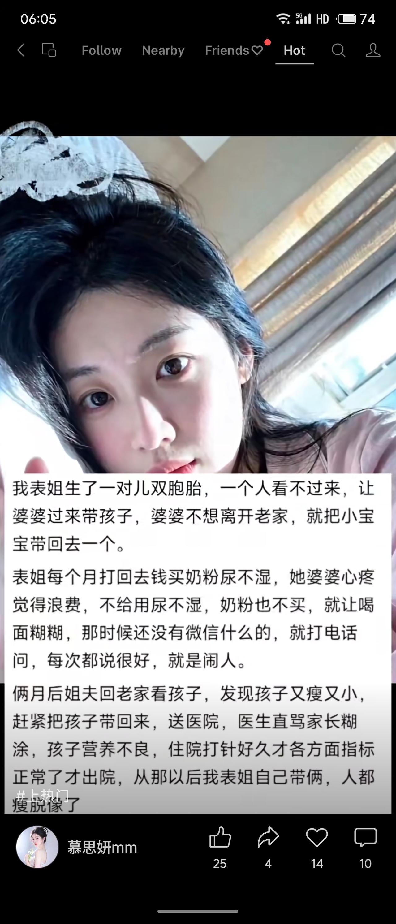 表姐生双胞胎，婆婆带走一个，为省钱不给奶粉尿不湿，只喂面糊糊。两个月后发现孩子严