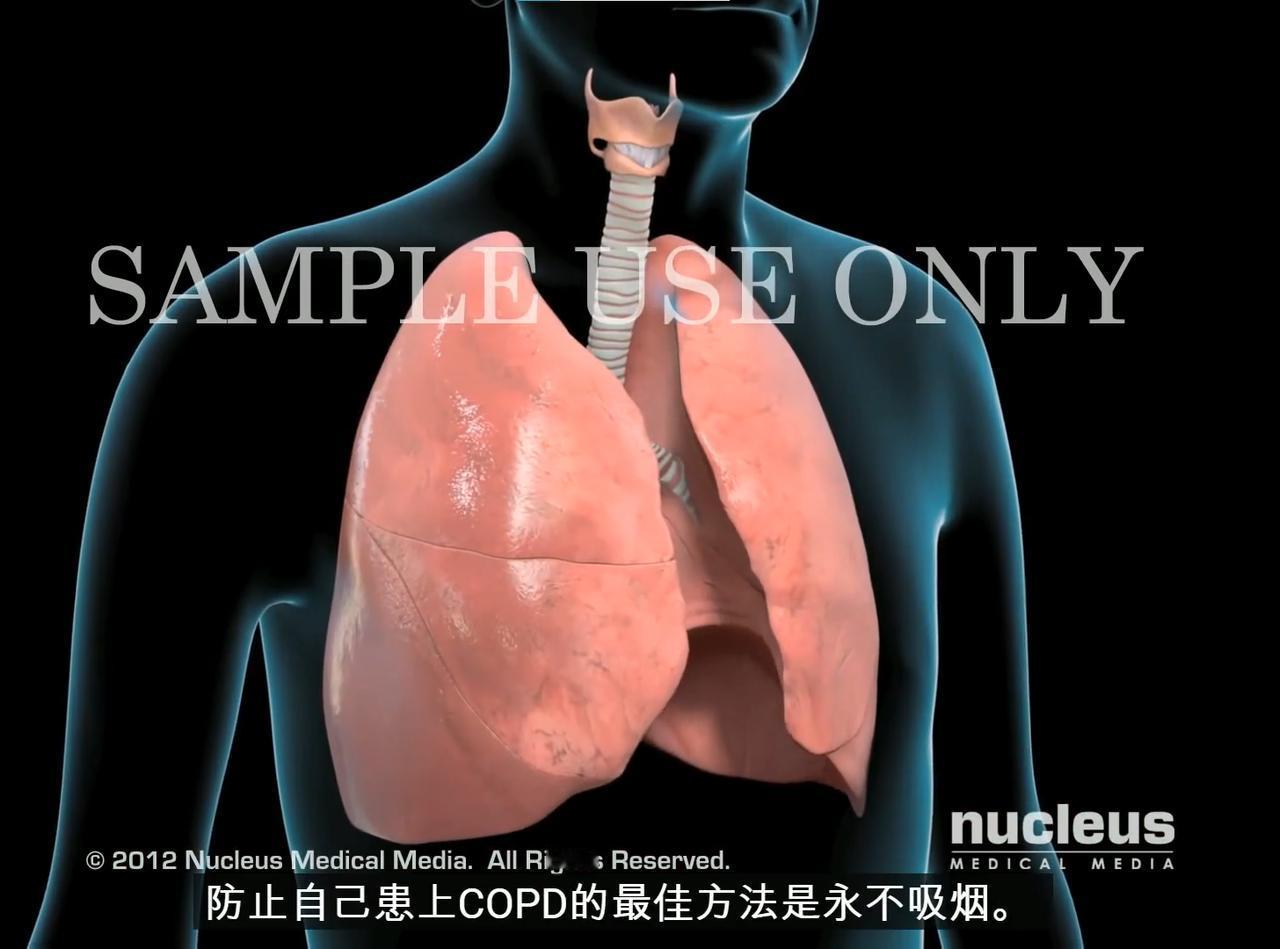 95%的慢阻肺患者，记好这个方法就够了！这可能是我最后一次分享这条内容了！之