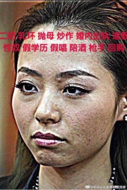 张靓颖在广州演唱会自曝做脸翻车，坦诚假期做医美因经验不足、操作过度，导致面部僵硬