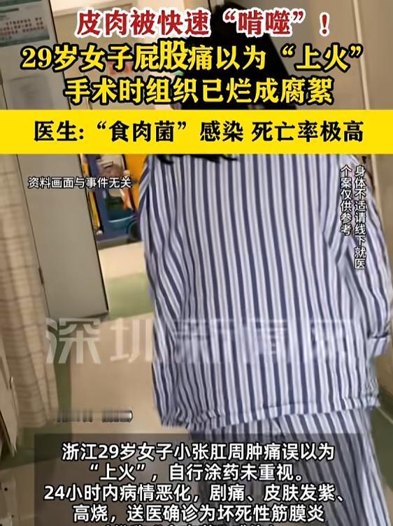 “悲剧还是发生了！”7月25日报道，浙江，一女子肛周肿痛，她以为是“上火”，涂了