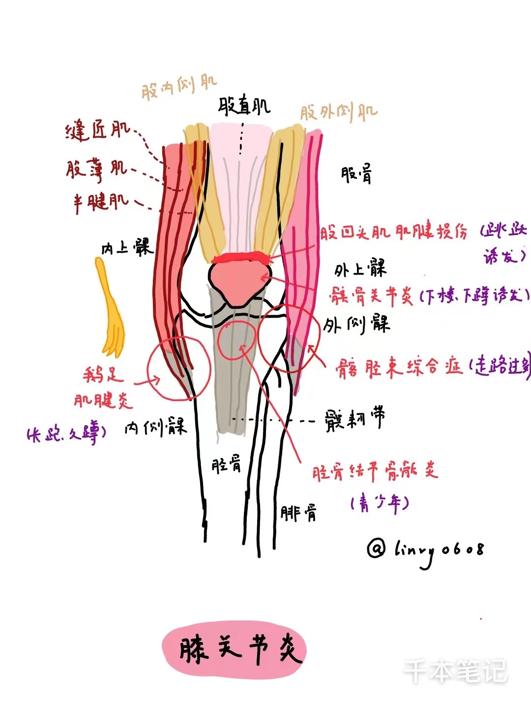 医学生绘本🎨第105弹【膝关节炎】