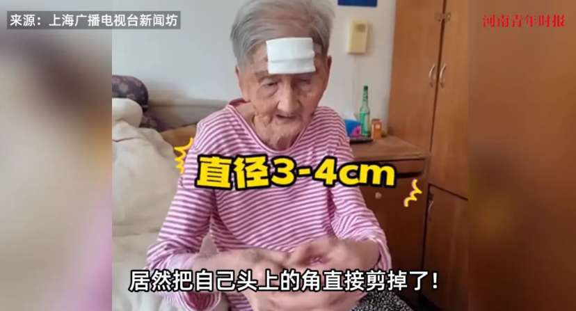 “活久见！”近日，上海，一98岁高龄的老太因为头上长了一个3公分的“犄角”，老太