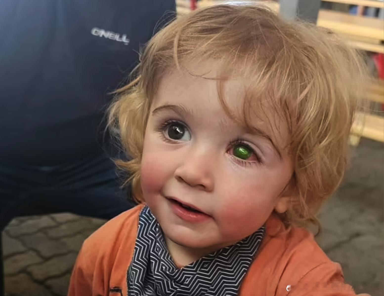 家里有小朋友的可注意了，千万别让别人（哪怕是熟人）随便亲孩子什么的！英国一名两岁