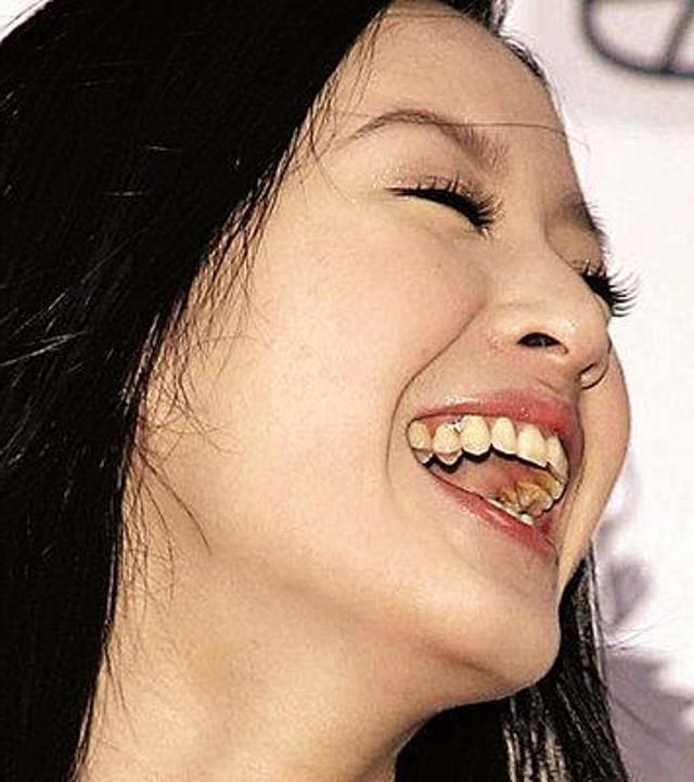 刷牙前牙膏要不要沾水? 很多人第一步就做错了, 怪不得满口黄牙!