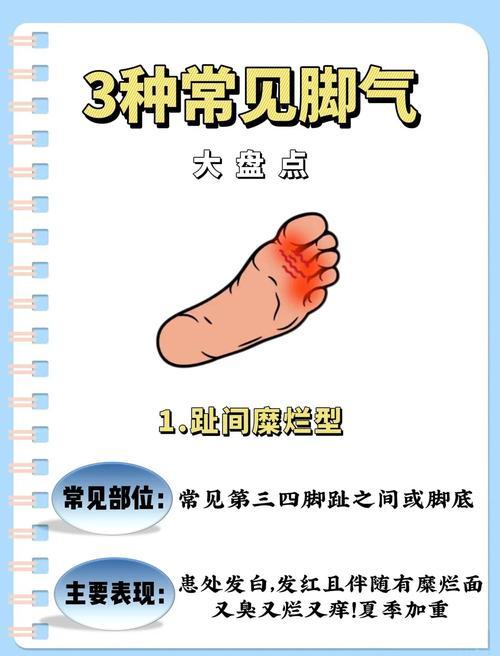 我发现脚气反反复复，根源大多不在脚，而是体内湿气太重很多中