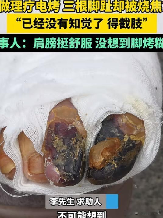4月25日报道，河南，54岁男子患有糖尿病，来到一家理疗店做电烤。谁知，在烤脚的
