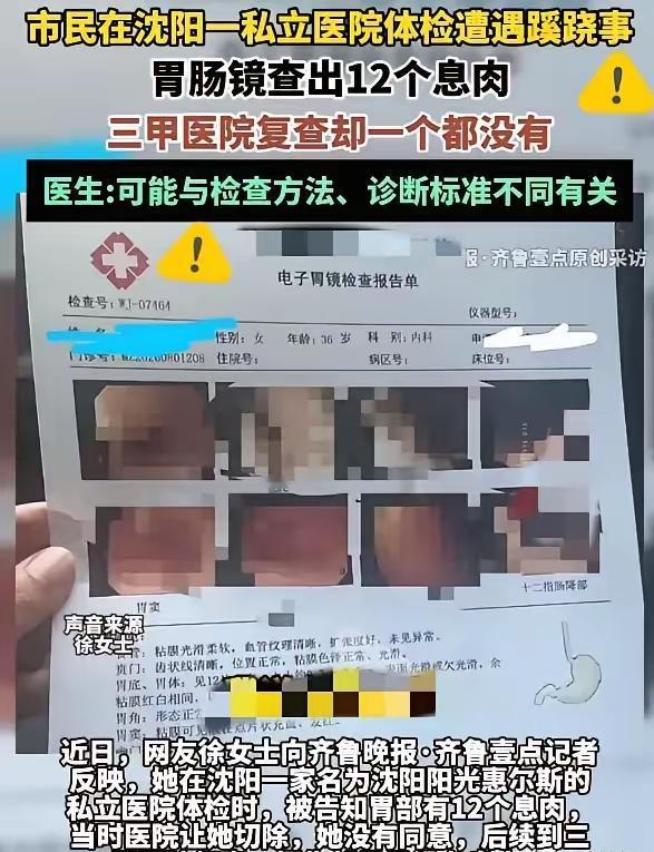 沈阳一个女子陪着自己的丈夫去做体检，顺便给自己做一个胃肠镜检查，这一下不得了了，