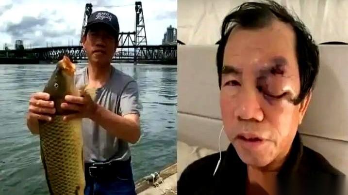 一棍子下来，左臂断了两处。他满脸是血，自己挣扎着爬上电车，一车厢的人，就这么直