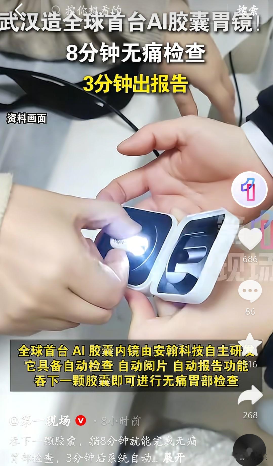 胶囊在胃里自动拍图，AI阅片灵敏度99%以上，以前医生看胃和小肠的片子要96分钟