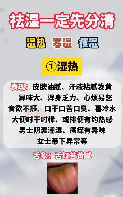 祛湿先分型：湿热、寒湿、痰湿的区别