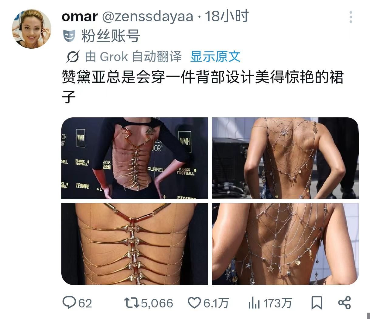 外网热议已经超过173万次观看“赞达亚总是会穿一件背部设计美的惊艳的裙子”
