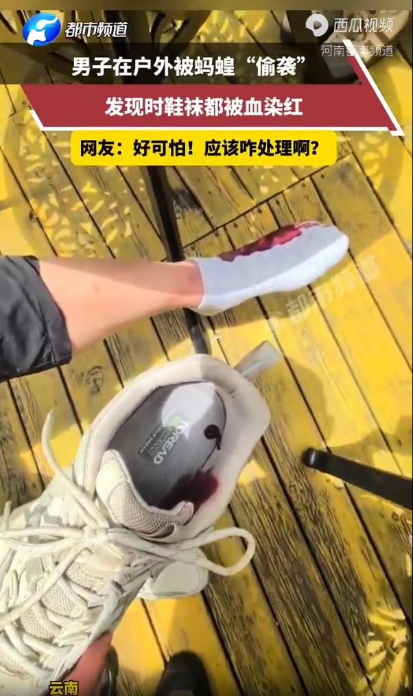 吓出一身冷汗！云南，一名户外大哥进山徒步全程没察觉半点疼痛，中途坐下休息脱鞋透气
