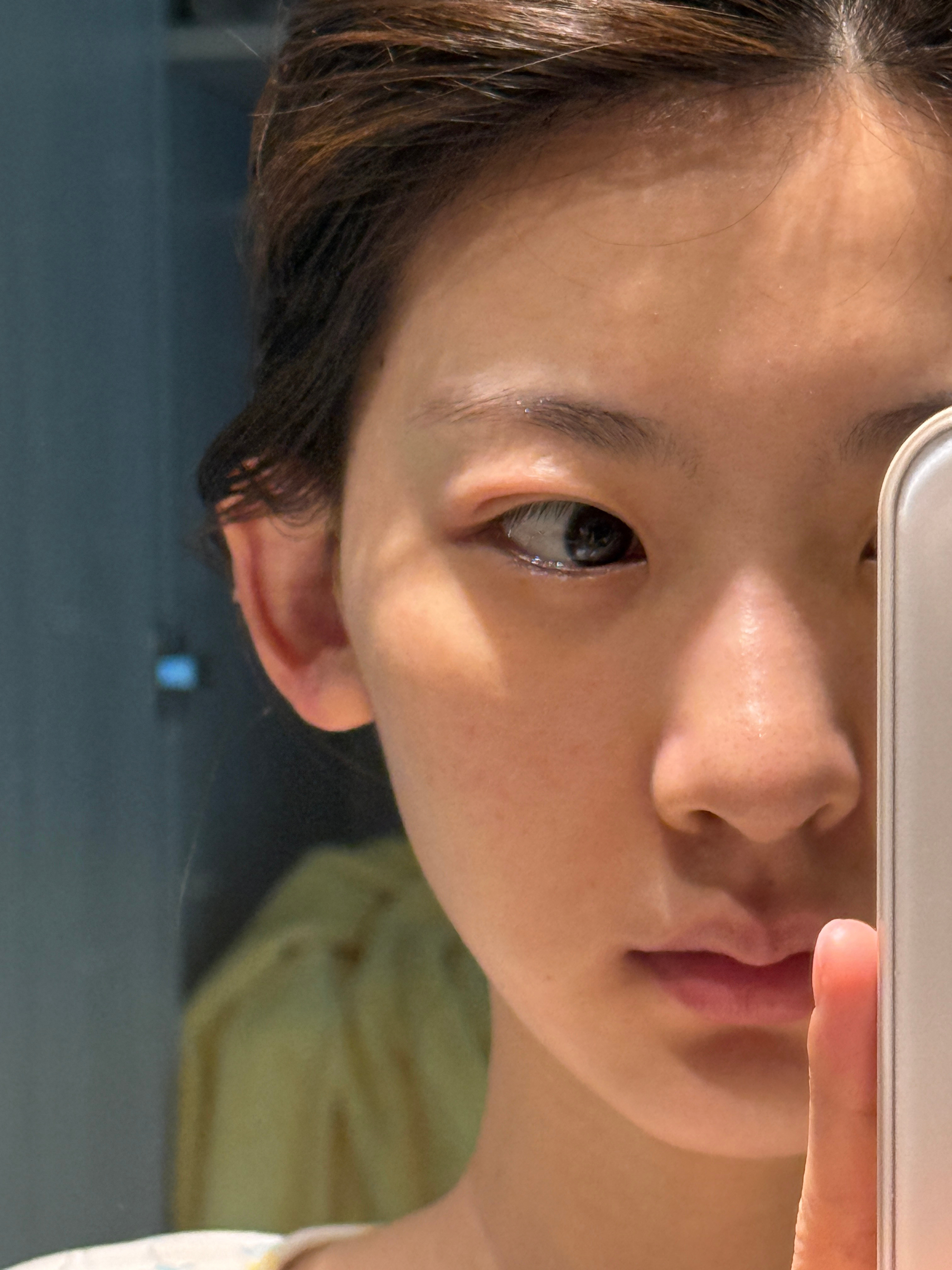 蚊子劳资恨死你了专挑眼睛耳朵咬🤬🤬🤬​​​