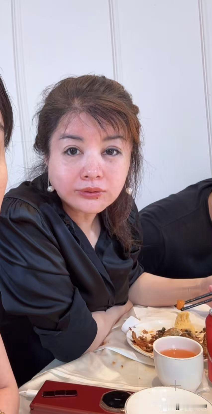 谢谢虞美人，让我看到了后遗症！谢谢她素颜让我看到了她的真实状态，整个人后遗症