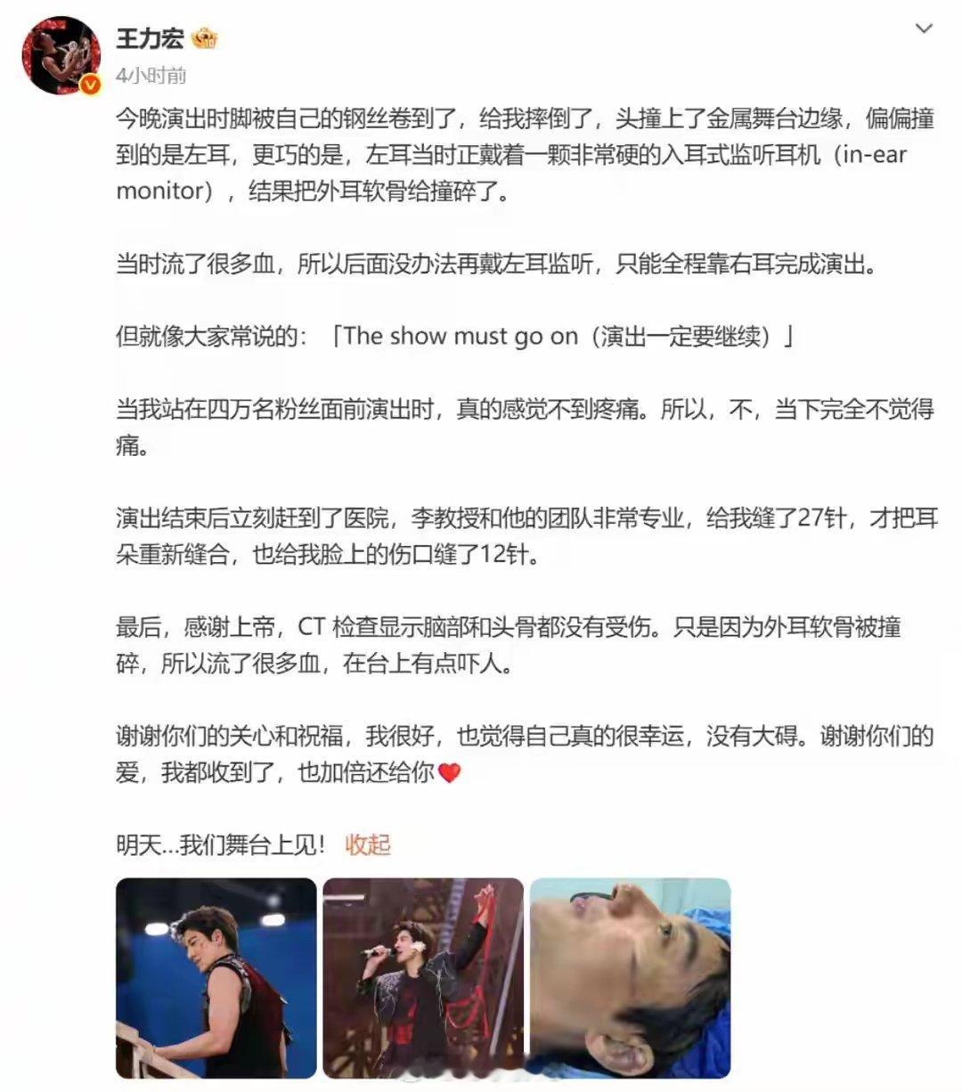 王力宏凌晨发文回应演唱会摔倒受伤：缝了39针7月4日，王力宏“最好的地方II”世