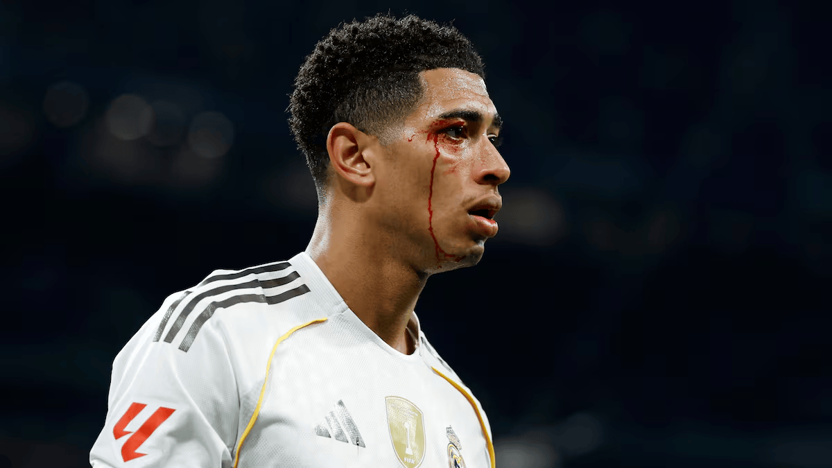 阿斯: 贝林出血对手却没吃牌, 皇马拿亚马尔举例称判罚双标