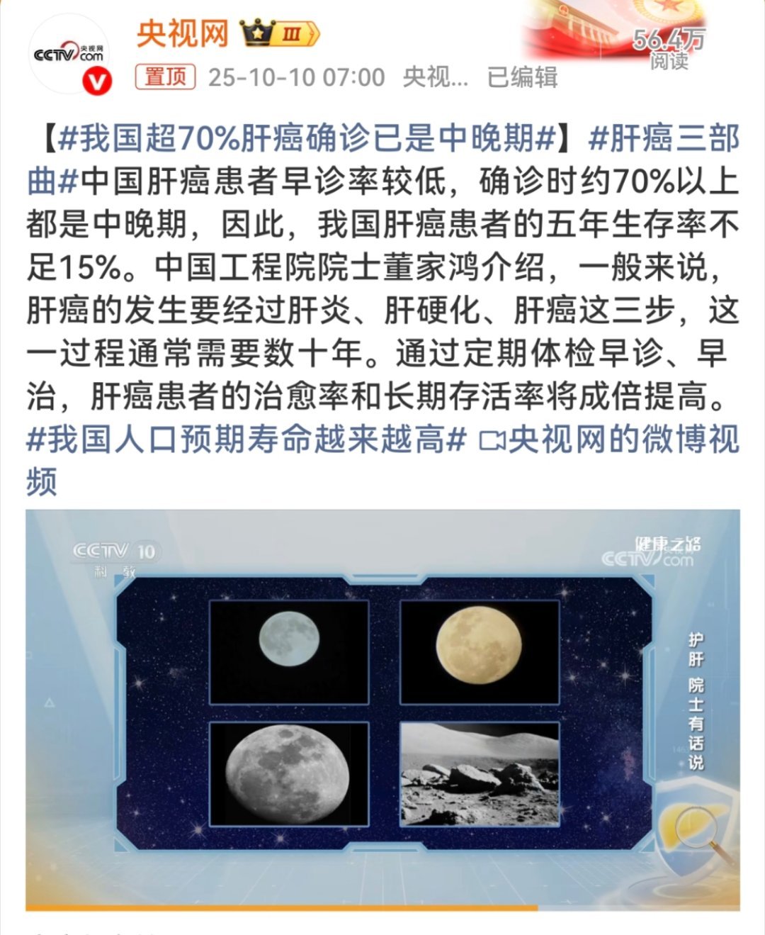 我国超70%肝癌确诊已是中晚期其实不是很想聊这个话题，但是还是要聊一下。肝癌确实