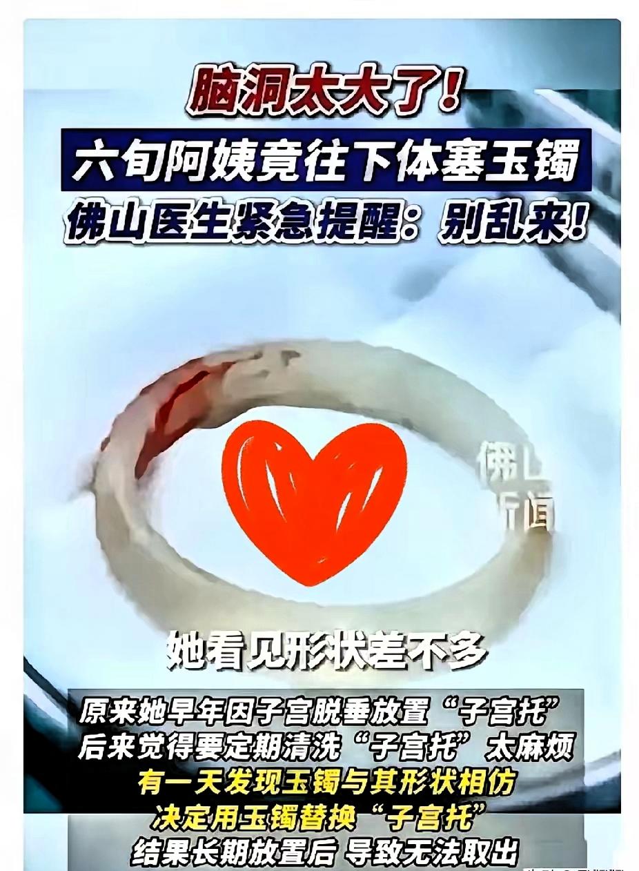 “聪明反被聪明误！”广东，一65岁阿姨因为“阴道异物”去医院检查，结果医生发现里