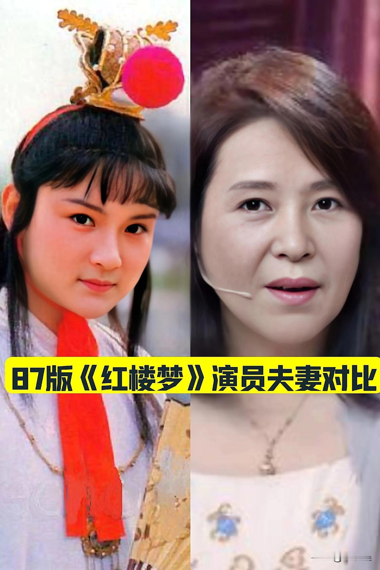 87版《红楼梦》演员夫妻对比经典影视电视剧