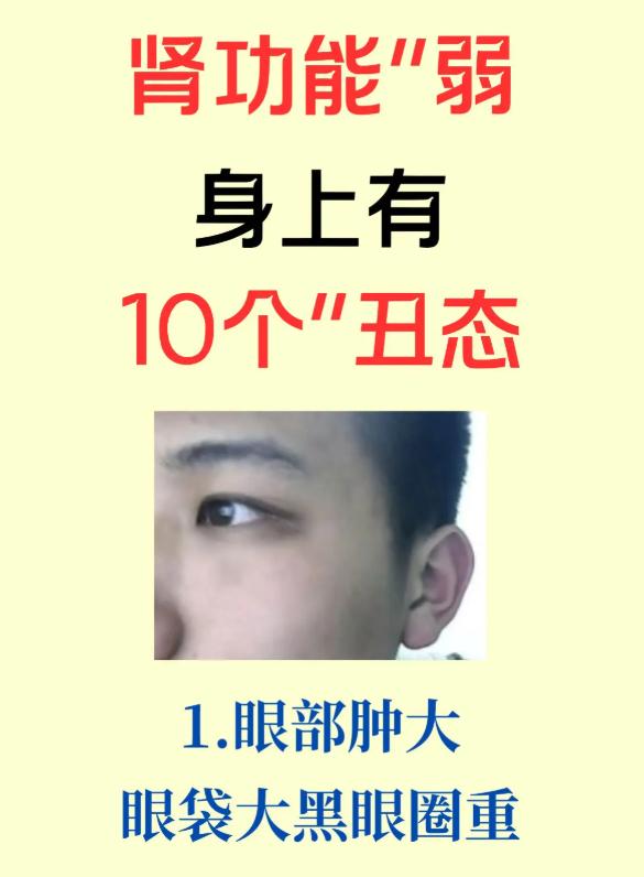 肾功能偏弱，身体有10个信号