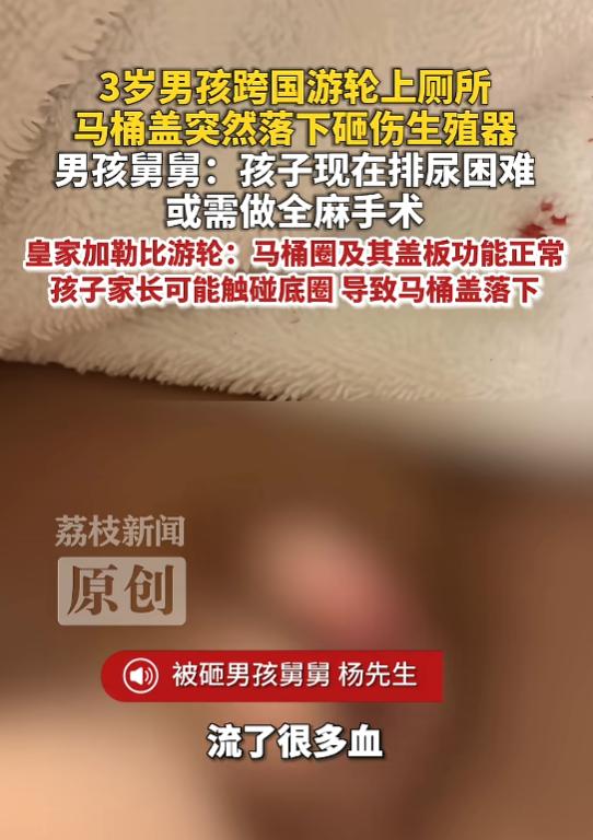 “防不胜防！”7月16日报道，3岁男孩在游轮上厕所时，马桶盖突然落下来，砸中了男