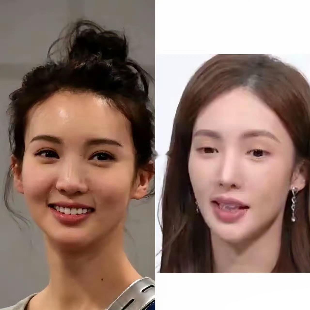 金晨早期的照片，肉嘟嘟的脸蛋，清纯、漂亮。那个样子，无论是演古装戏还是现代爱情剧