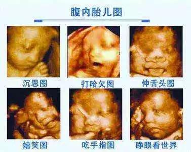 做四维彩超宝宝不配合怎么办?