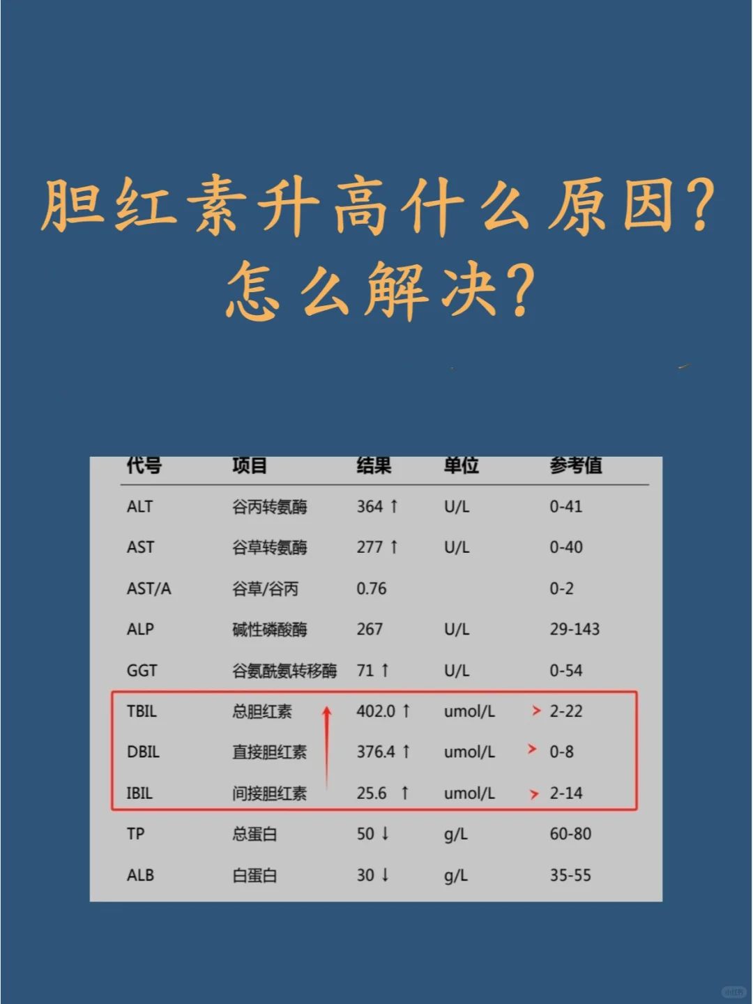 胆红素升高什么原因?怎么解决? 肝功能化验单有个非常重要的指标就是胆红...