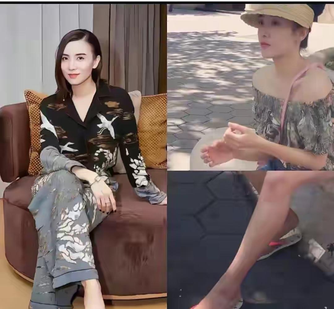 宋佳，一对比脚趾甲还是黑色好看。