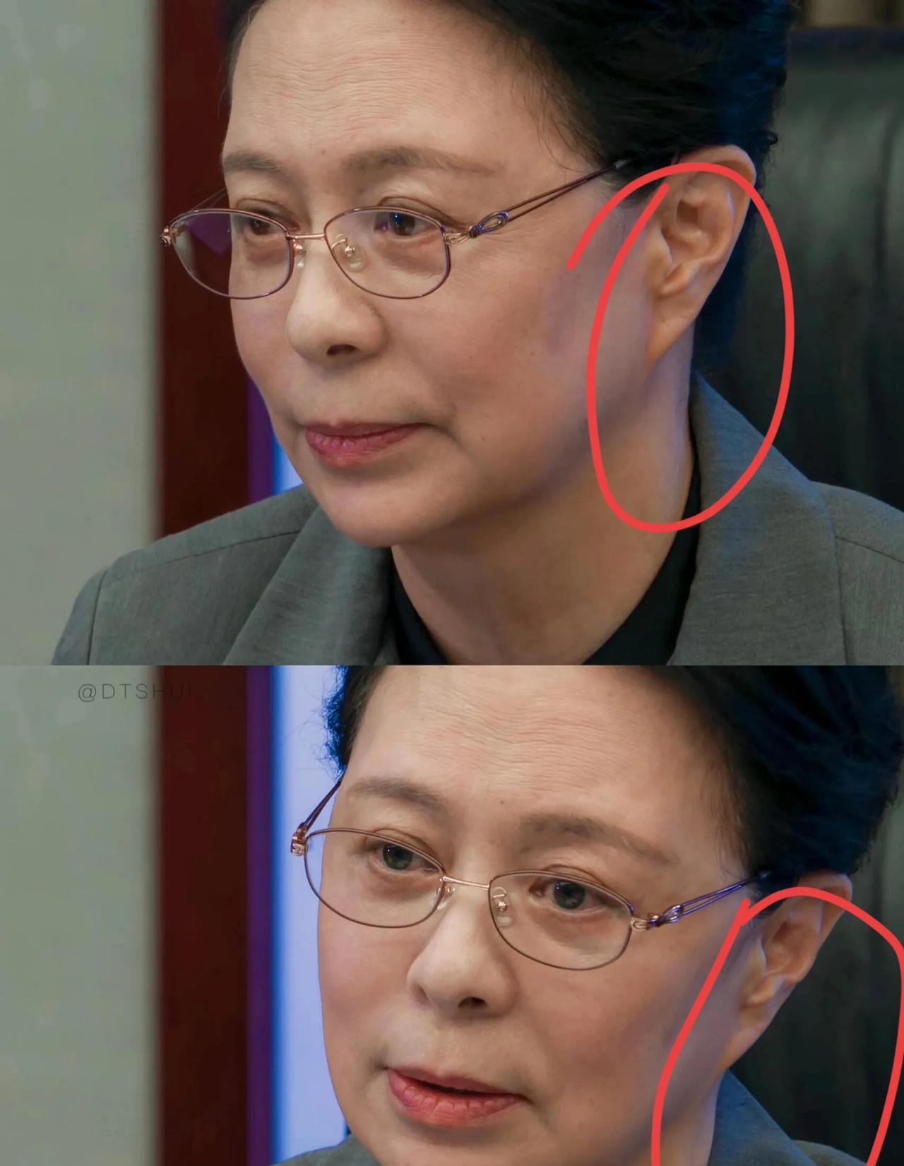 《以法之名》兰景铭这个耳朵是拉皮了吗？不太正常呀！[呲牙笑]刚刚看剧发现兰书记这