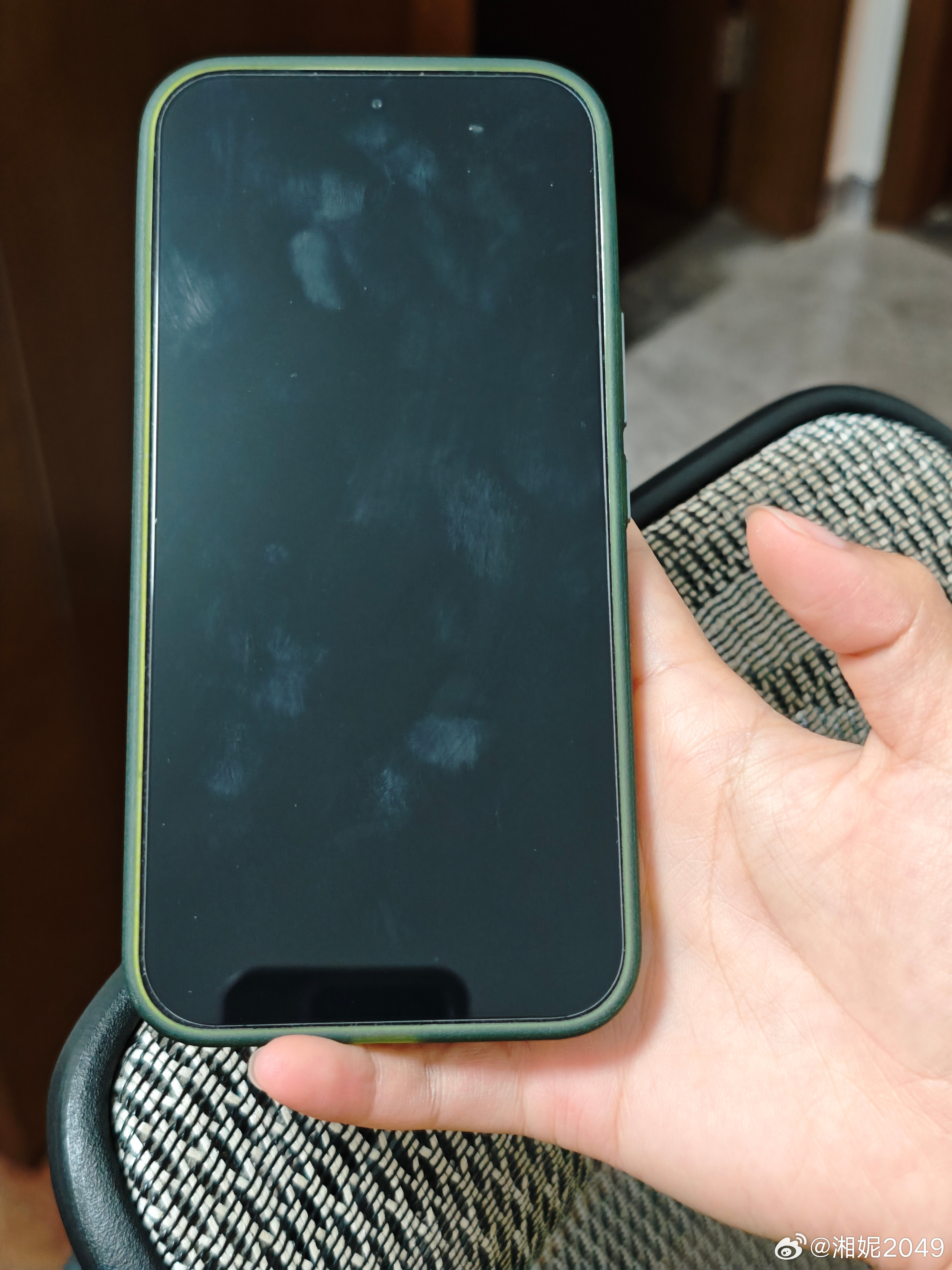 我就是天天用小拇指支着玩手机的大家觉得我右手小拇指的形变和左手比有啥区别？