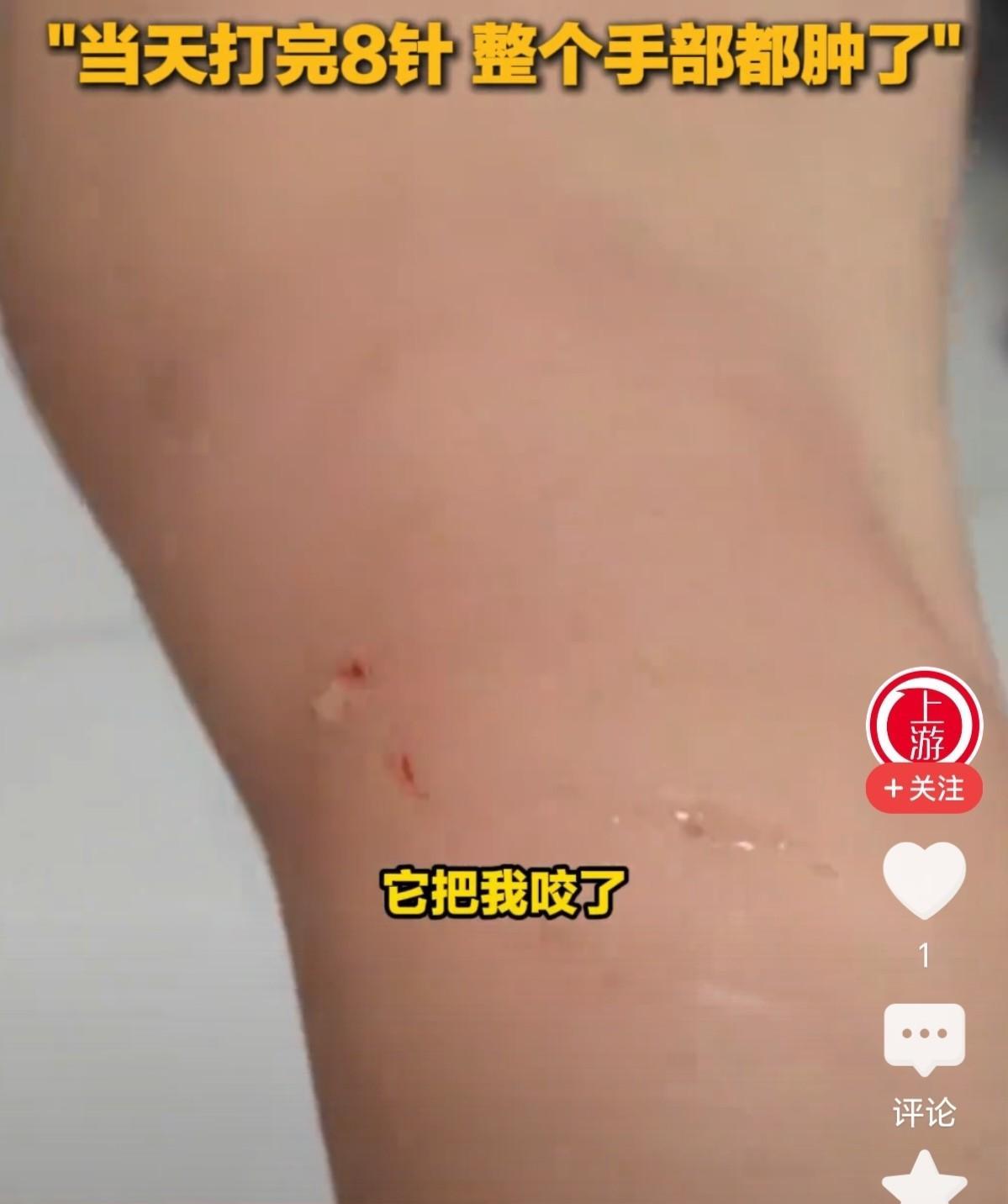 这女人真狠！家里马桶突然冒出一个蝙蝠，她不仅没有吓到大声尖叫，反而是徒手去