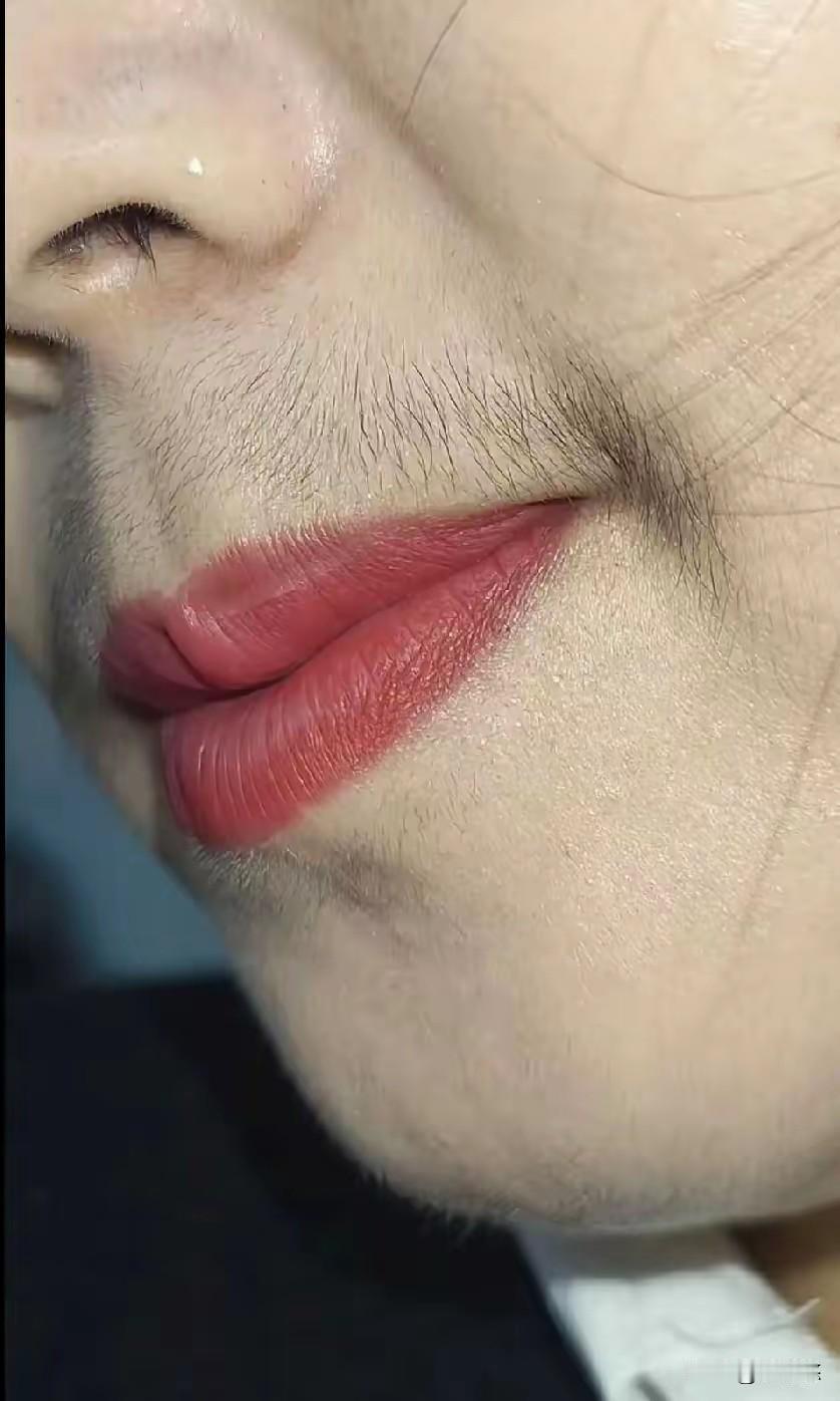 哎妈呀，平时就知道闺蜜胡须重，没想到放大了看这么吓人。这是雄性激素过多吗？我们