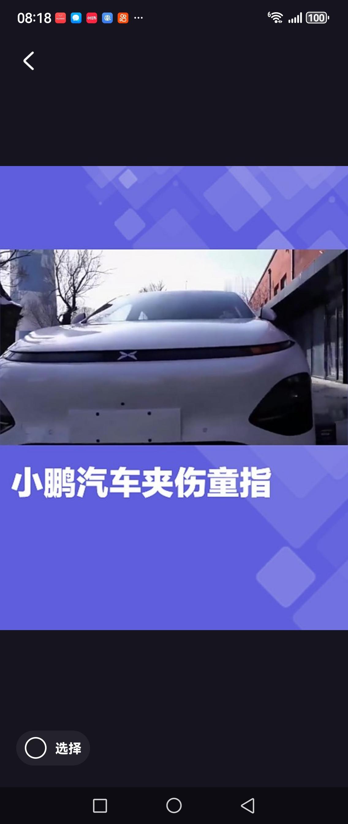 试驾时脚被感应门夹到，店员却反要顾客赔偿？小鹏汽车门店这波操作，真是让人大跌眼镜