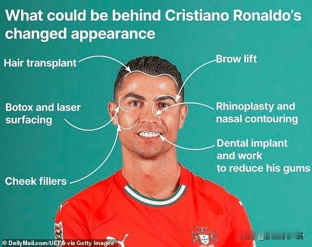 不出意外意外果然还是发生了C罗竟然整容，而且还不只整了一处！纽约整形主任说