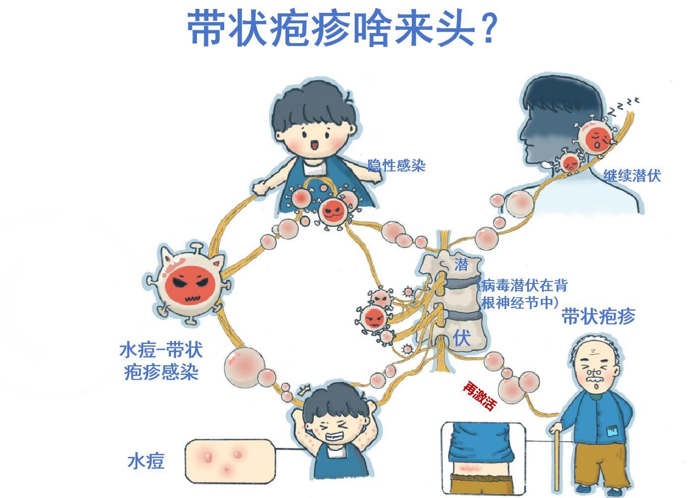 别再忽视！带状疱疹真的不是小问题，最近身边好多人都在说带状疱疹，这个听起来陌生又