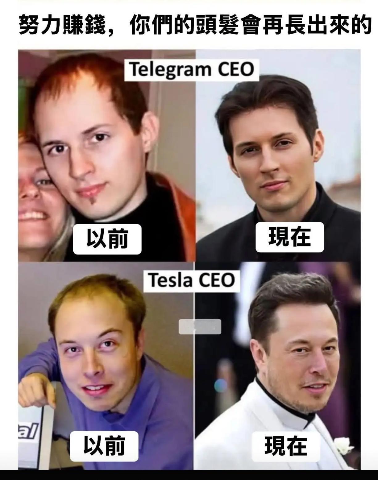 努力賺錢，你們的頭髪會再長出來的​​​